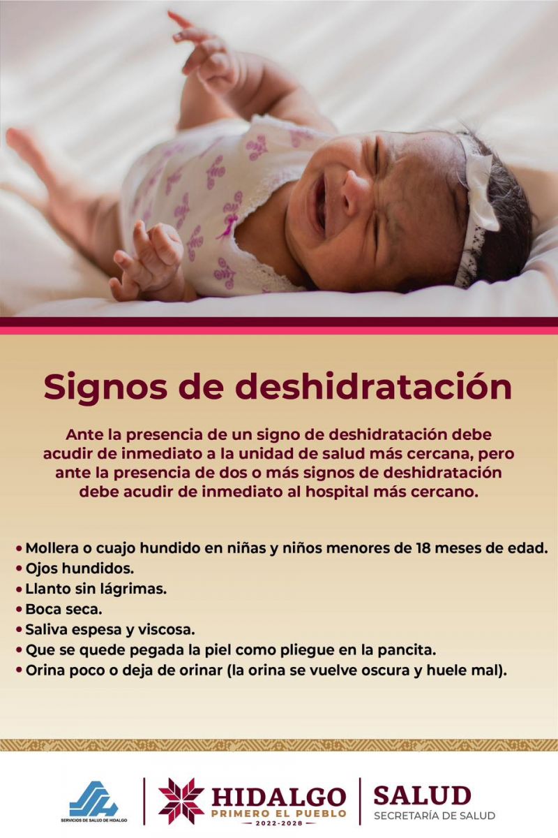 Signos de Deshidratación